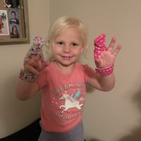 Little girl wearing fabric finger guards